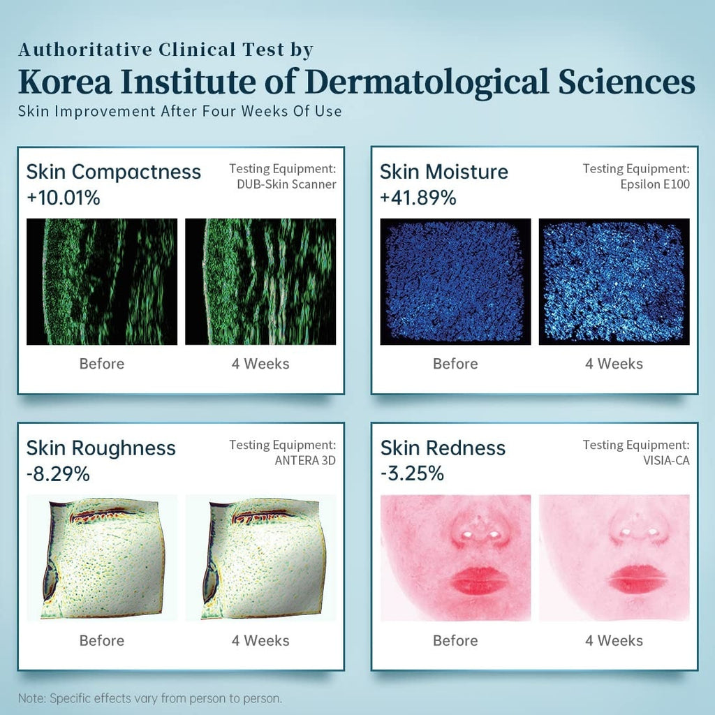 Silicone LED Light Therapy Facial Mask- At-Home Anti-Aging and Radiance Care!